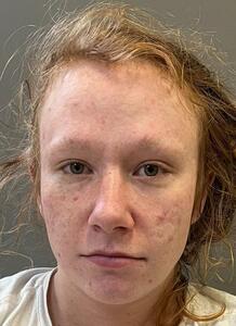 Mugshot of BROWNING, CANDIE RENEE